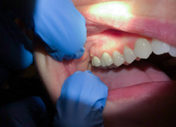Best Pediatric Emergency Dentist in Bensenvle, IL
